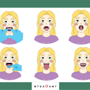 Ćwiczenia przed i po podcięciu wędzidełka języka - Dziewczynka (PDF)